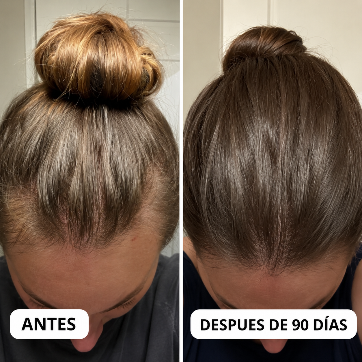 Resultados Reales